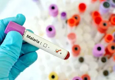 gloved hand holding test tube of blood with a label marking the sample as positive for malaria. There are tubes with lids of various colors in the background. gloved hand holding test tube of blood with a label marking the sample as positive for malaria. There are tubes with lids of various colors in the background.